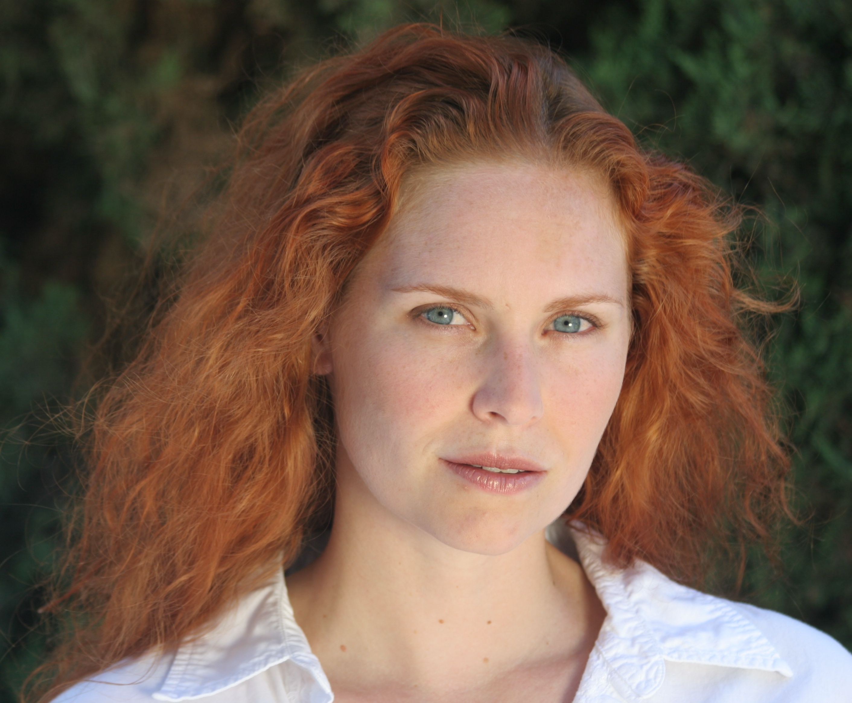 A woman with the “red hair” allele.